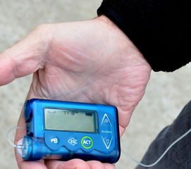 区块链排线兜底在理财中的风险控制逻辑